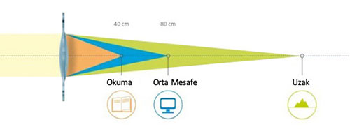 Akıllı Lens Nedir?
