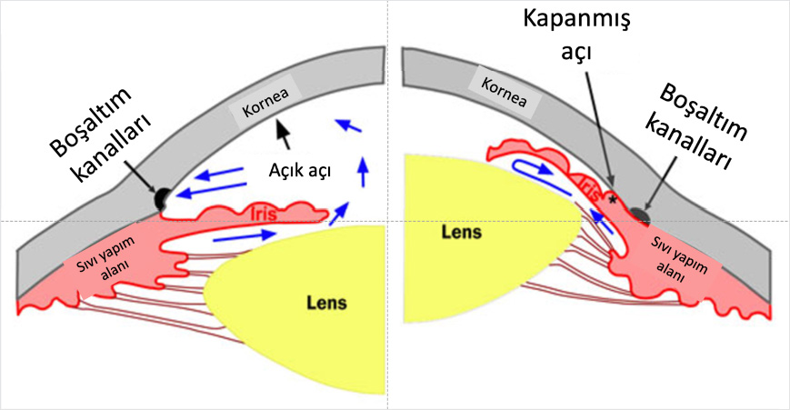 Glokom Nasıl Oluşur?
